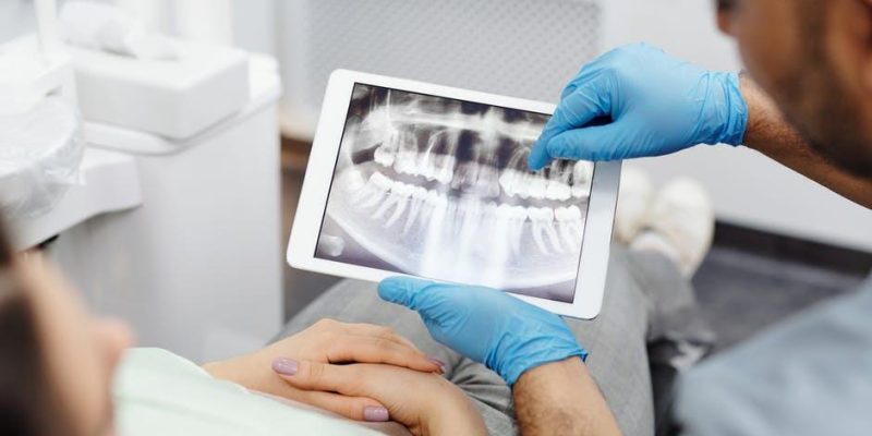 invisalign procedure